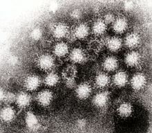Norovirus Disinfection and control
